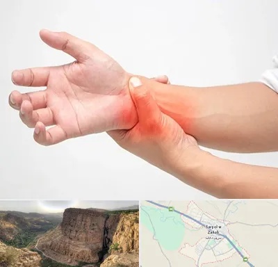 دکتر متخصص دست در سرپل ذهاب
