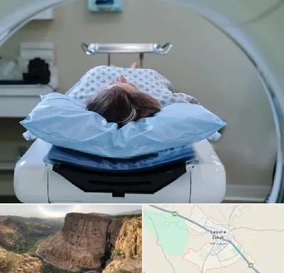 رادیولوژی فک و صورت در سرپل ذهاب
