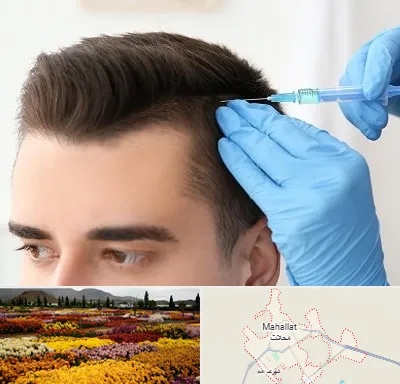 مزوتراپی مو در محلات