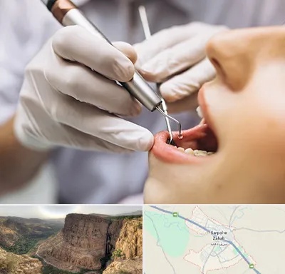 دندانپزشکی ارزان در سرپل ذهاب