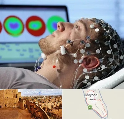 مرکز نوار مغز در میبد