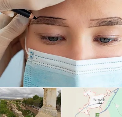 کاشت ابرو در کنگاور