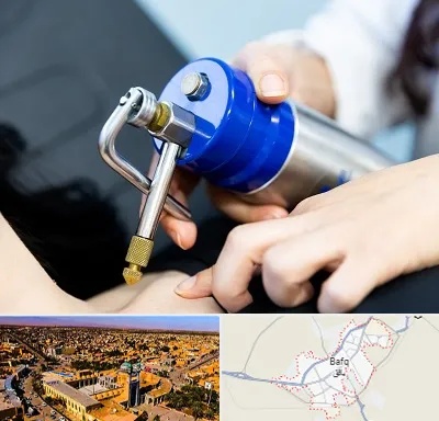 کرایوتراپی در بافق