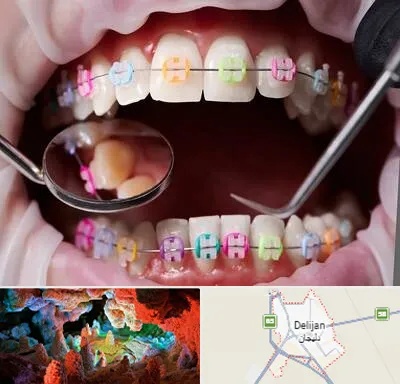 متخصص ارتودنسی در دلیجان