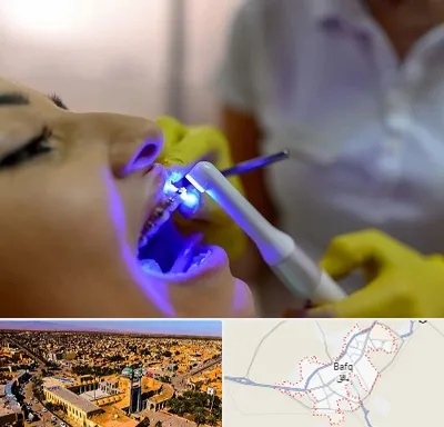 دندانپزشکی با لیزر در بافق