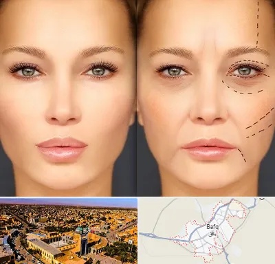 متخصص زیبایی چشم در بافق