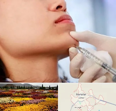 زاویه سازی صورت در محلات