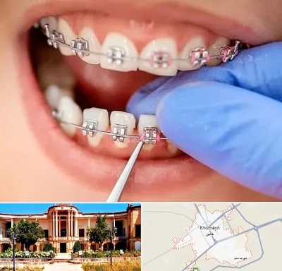 مرکز ارتودنسی دندان در خمین