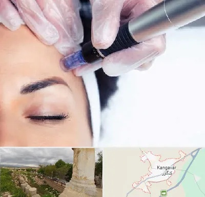 کلینیک مزوتراپی صورت در کنگاور