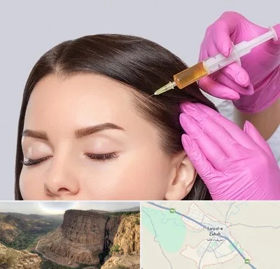 تزریق هیر فیلر در سرپل ذهاب