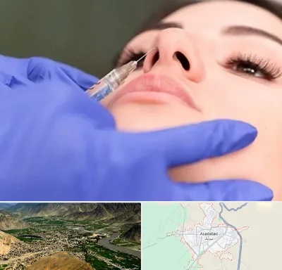 هیالاز در اسدآباد