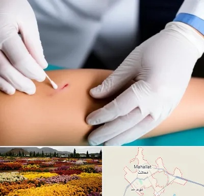 متخصص زخم عفونی در محلات