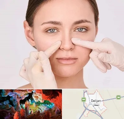 جراح راینوپلاستی در دلیجان