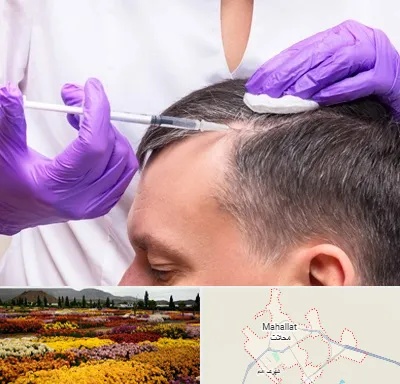 دکتر فوق تخصص پوست و مو در محلات