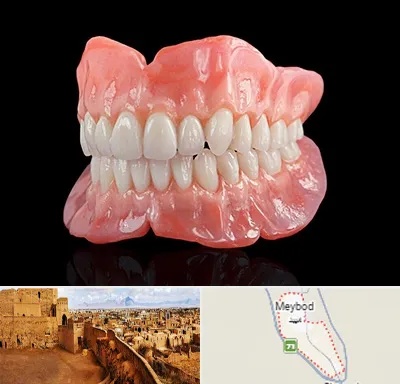 ساخت دندان مصنوعی در میبد