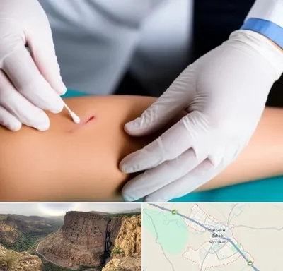 متخصص زخم عفونی در سرپل ذهاب