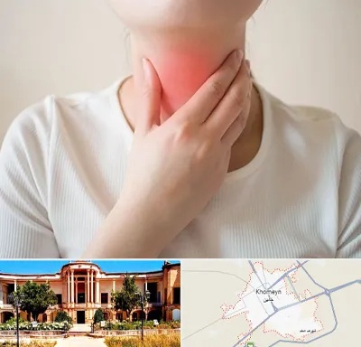 دکتر سرطان مری در خمین