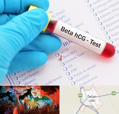 آزمایشگاه بارداری در دلیجان
