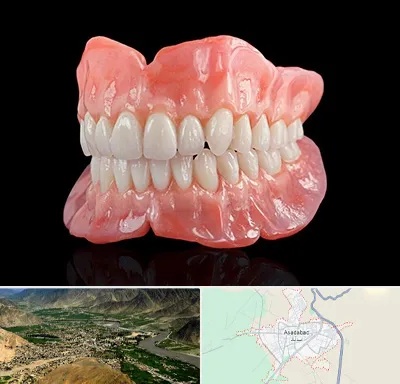 ساخت دندان مصنوعی در اسدآباد
