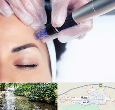 کلینیک مزوتراپی صورت در هرسین