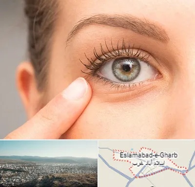 جراح پف چشم در اسلام آباد غرب