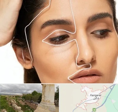 عمل بینی اقساطی در کنگاور