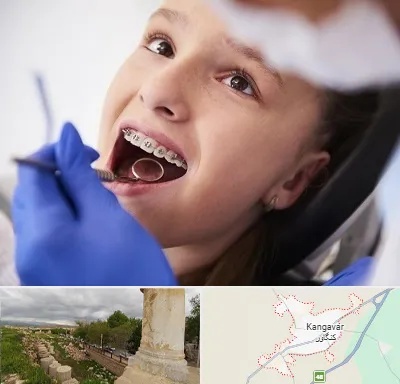دکتر ارتودنسی کودکان در کنگاور