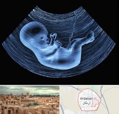 دکتر متخصص غربال گری در اردکان