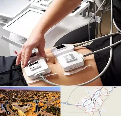 ترواسکالپ در بافق