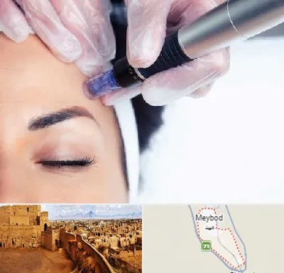 کلینیک مزوتراپی صورت در میبد