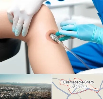 اوزون تراپی در اسلام آباد غرب