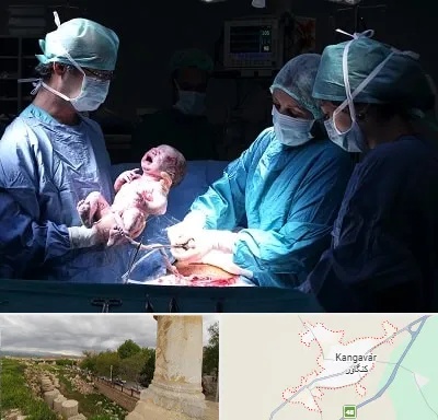 جراح سزارین در کنگاور