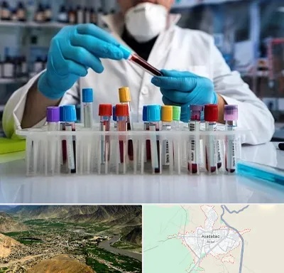 آزمایشگاه خون در اسدآباد