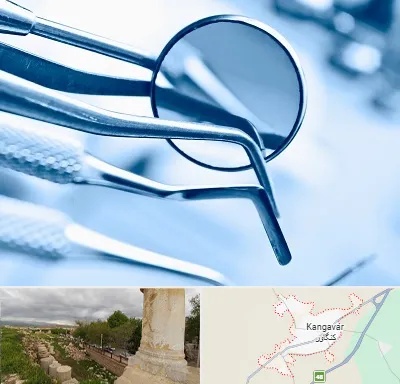 تجهیزات دندانپزشکی در کنگاور