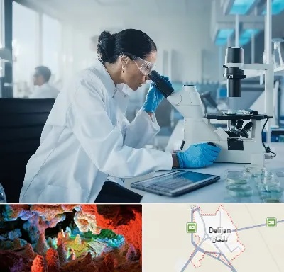 آزمایشگاه HPV در دلیجان
