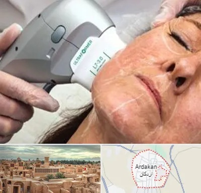 آموزش هایفوتراپی در اردکان