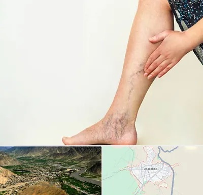 دکتر واریس در اسدآباد