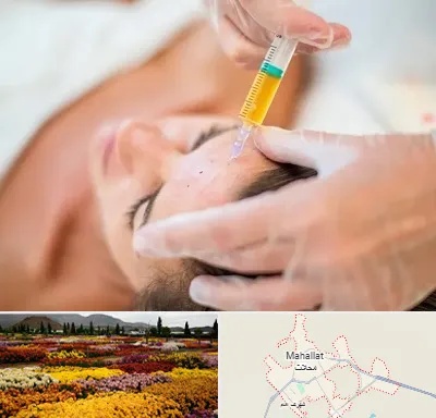 پی آر پی در محلات