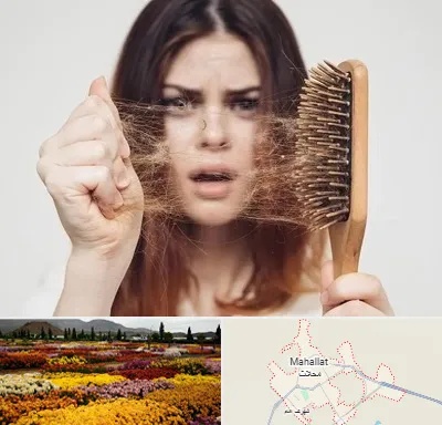 دکتر ریزش مو در محلات
