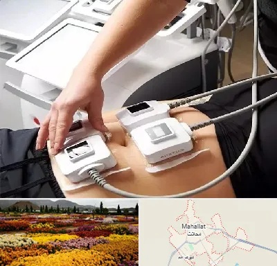 ترواسکالپ در محلات