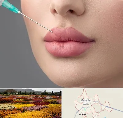 کلینیک ژل لب روسی در محلات