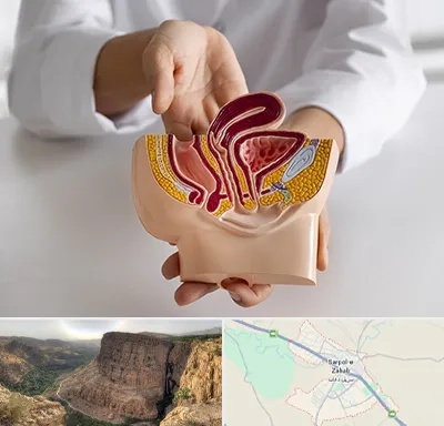 دکتر دستگاه تناسلی مردان در سرپل ذهاب