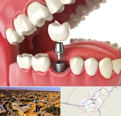 متخصص پروتز دندان در بافق