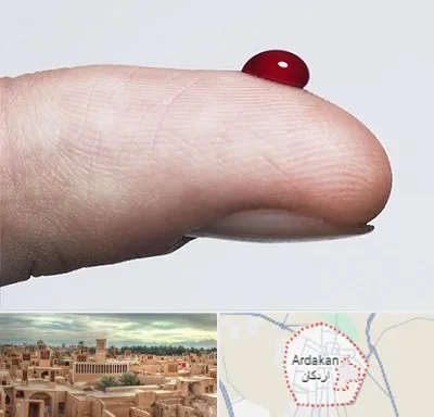 مرکز فصد خون در اردکان