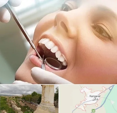دندانپزشکی زیبایی در کنگاور