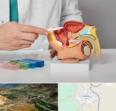 دکتر اورولوژی در اسدآباد
