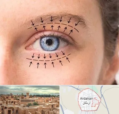 عمل افتادگی پلک در اردکان