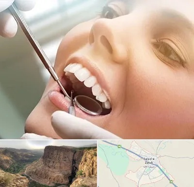 دندانپزشکی زیبایی در سرپل ذهاب