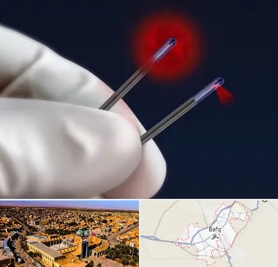 جراحی سینه با لیزر در بافق