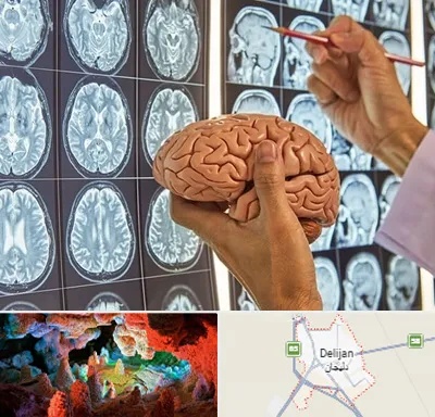 دکتر فوق تخصص جراح مغز و اعصاب در دلیجان